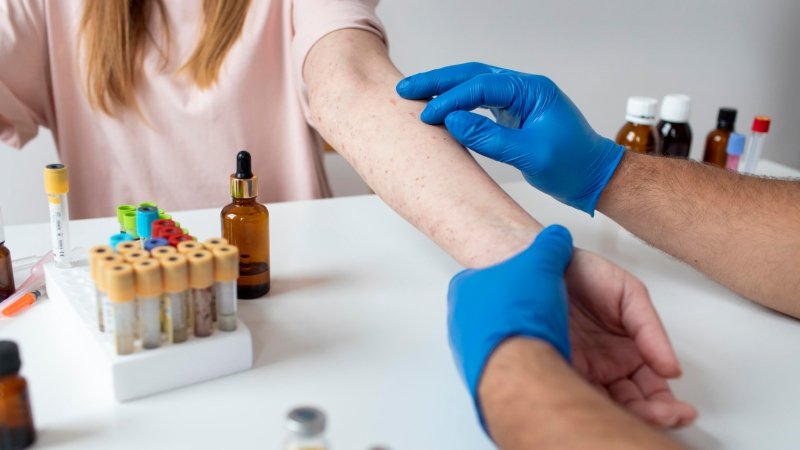 KPV Peptide for Wound Healing